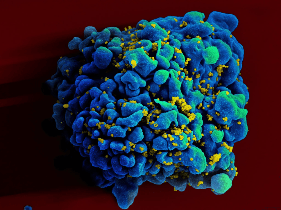 How HIV-infected cells use immune checkpoints to evade the human immune system