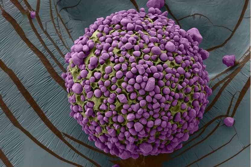 Edible Microparticles: A Revolutionary Solution to Global Vitamin A Deficiency