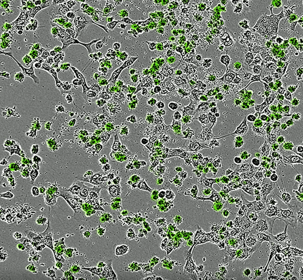 Finding the straw that breaks the cancer's back?