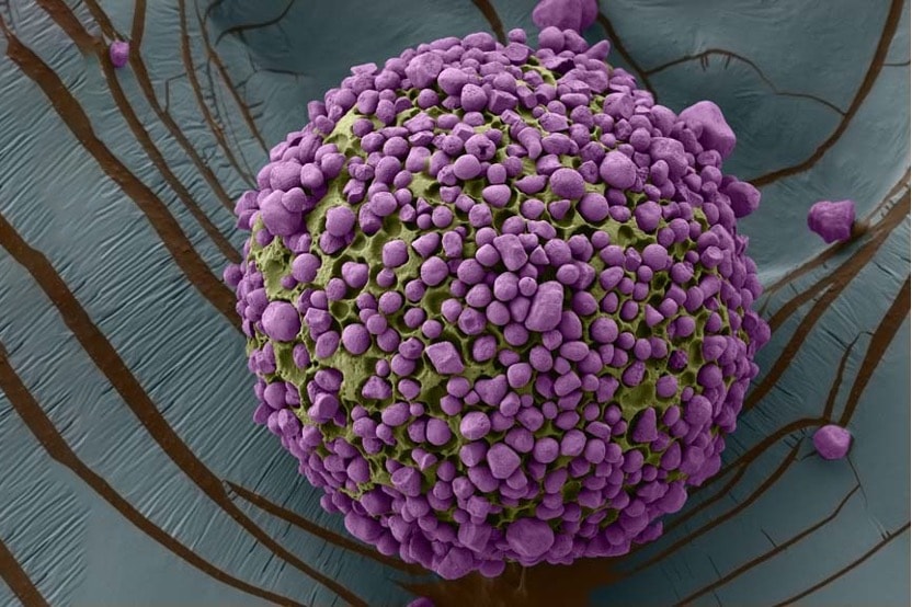 Edible Microparticles: A Revolutionary Solution to Global Vitamin A Deficiency