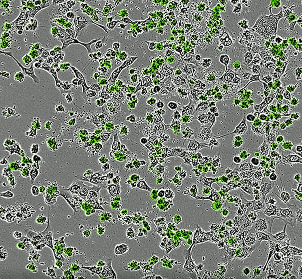 Finding the straw that breaks the cancer's back?