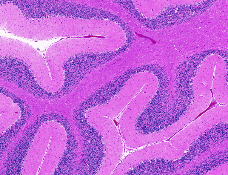The Impact of SARS-CoV-2 on the Brain: It Is All in Your Head