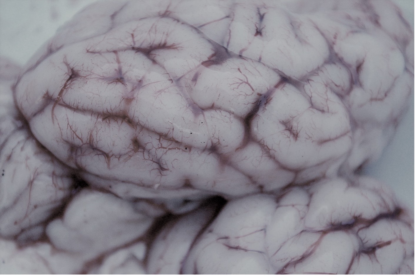 How to counteract age when the nervous system is damaged