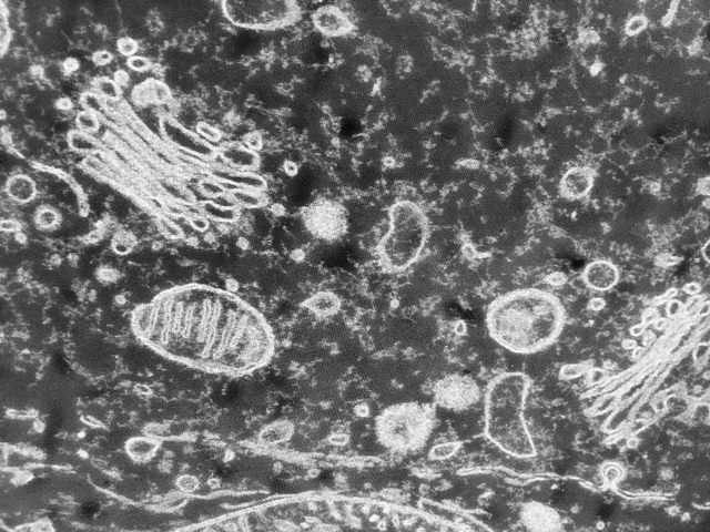Living without mitochondria: the downfall of one textbook truth