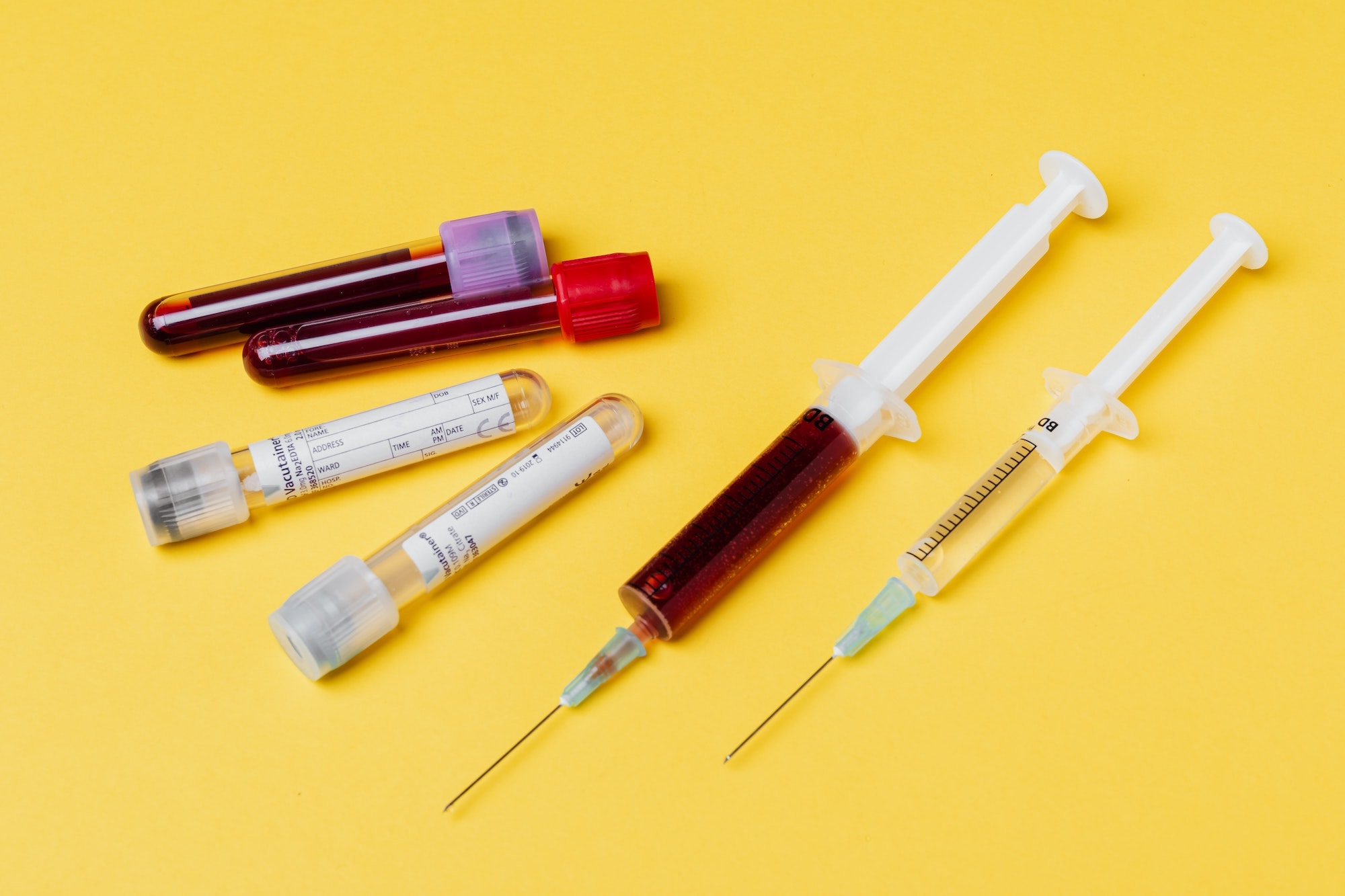 The needle-free detection of SARS-CoV-2-specific antibodies from urine