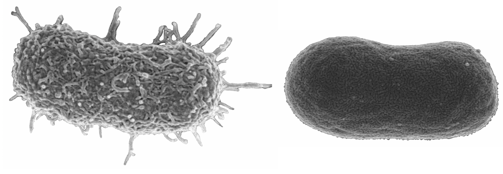 Unlocking a new way to fight against antibiotic resistance: viruses are the key
