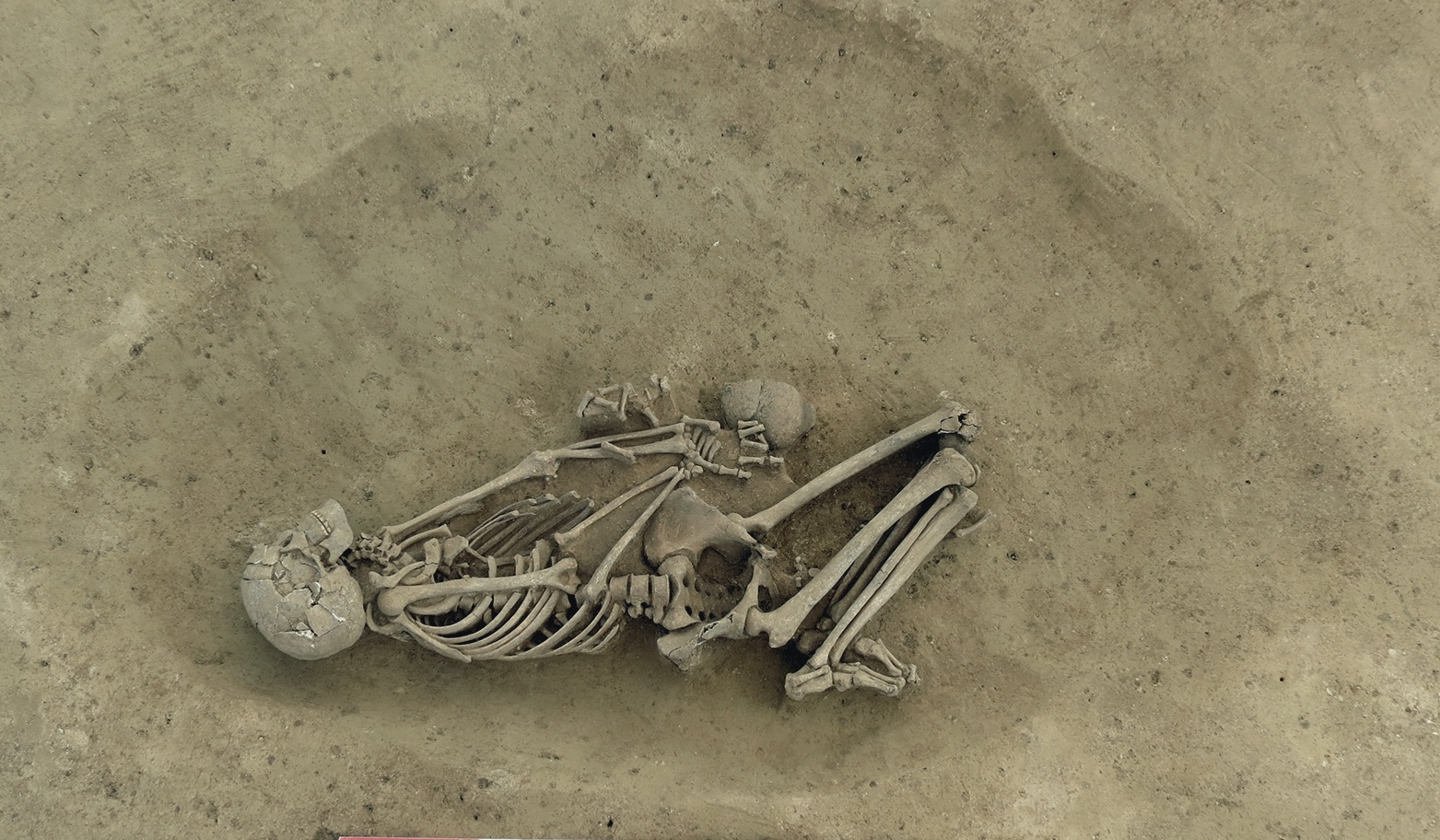 Early Neolithic burial from Alsace (Morschwiller-le-Bas  Ungeheuer Hoelzle, Haut-Rhin)