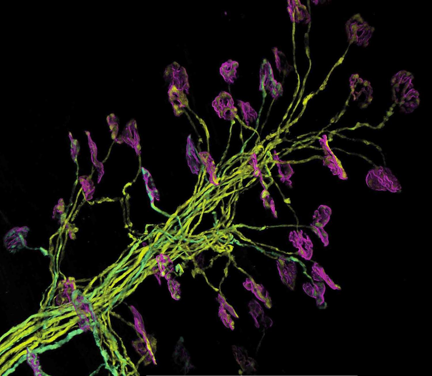 Multiphoton microscopy of mouse motor neurons