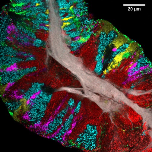 Microscope picture of microbes on a human tongue. Each small dot shows a bacterial cell and the colors indicate different types of bacteria. The wide gray stripe at the core comes from human tongue cells.