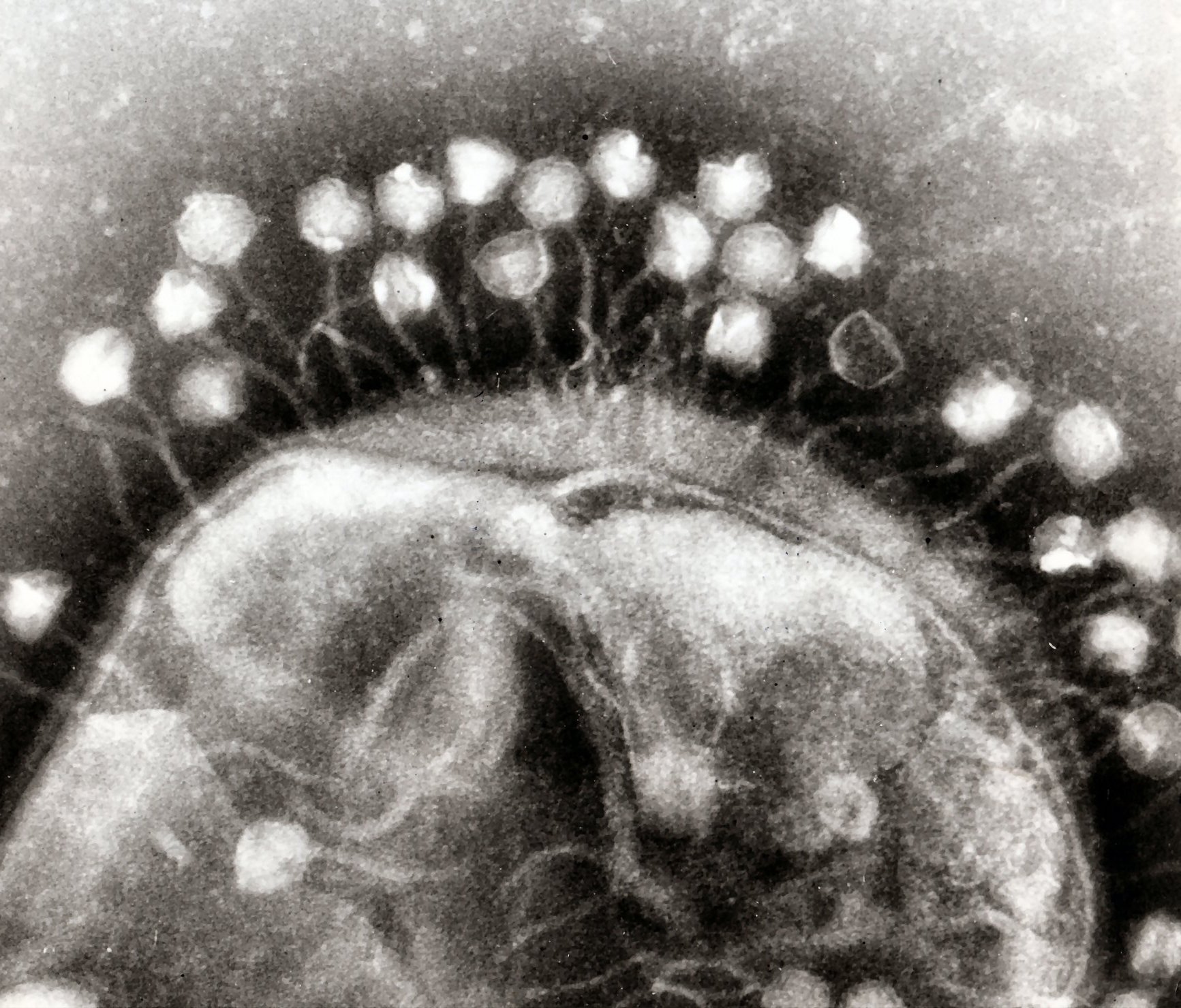 Electron micrograph of bacteriophages attached to a bacterial cell (source Wikipedia).