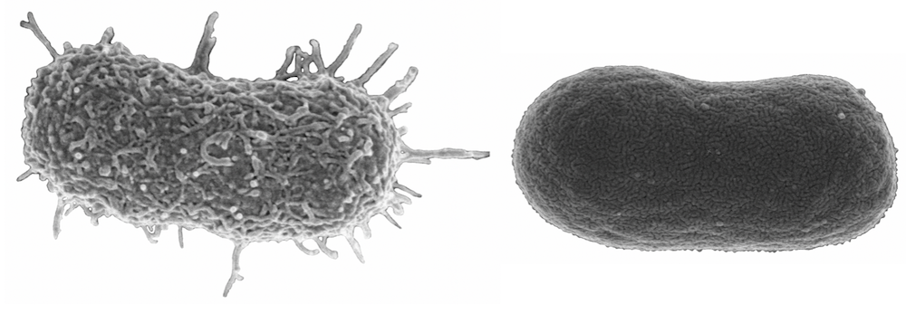 Scanning electron micrographs of Acinetobacter baumannii.