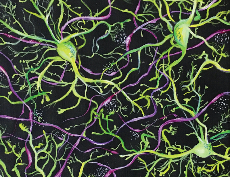 Artistic rendering of images collected by microscopy shows microglia (green) surrounded by neuronal axons (magenta) releasing norepinephrine (white speckles) in the waking brain.